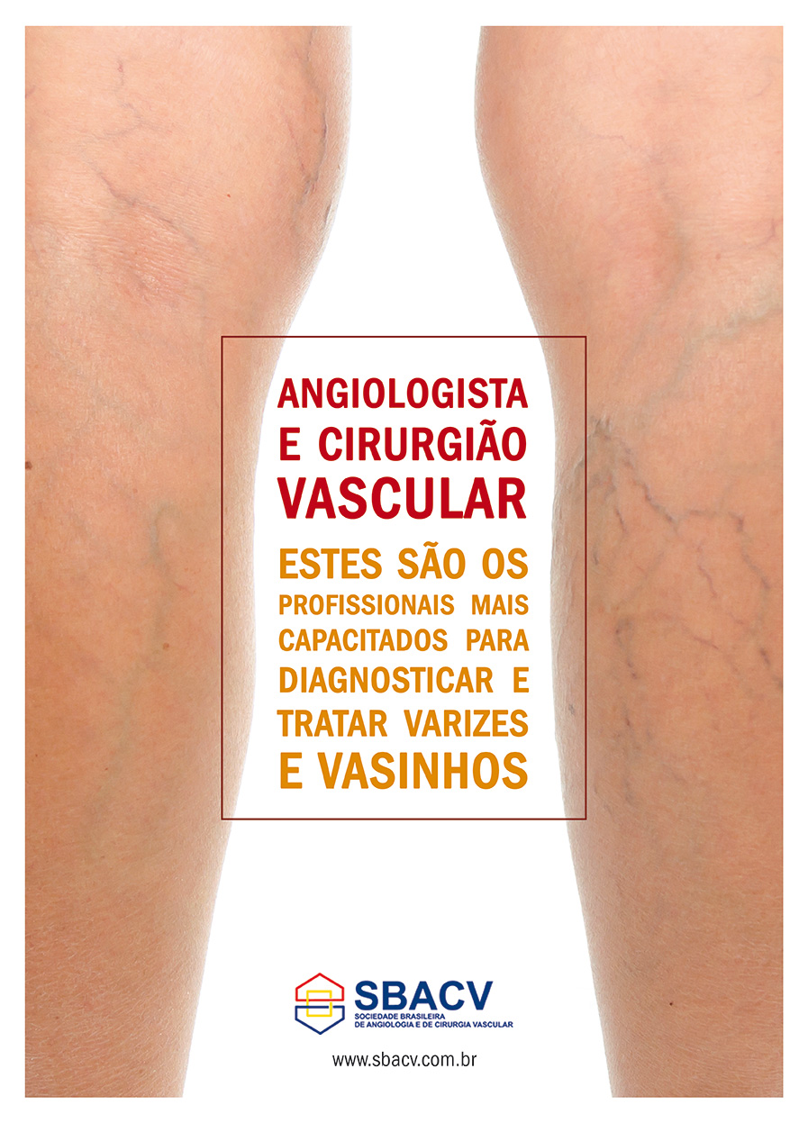 Angiologsita e Cirurgião Vascular