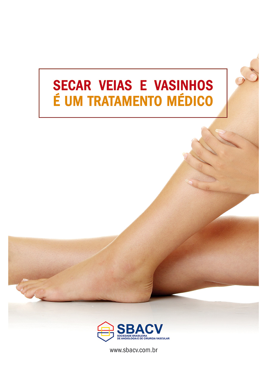 Angiologsita e Cirurgião Vascular