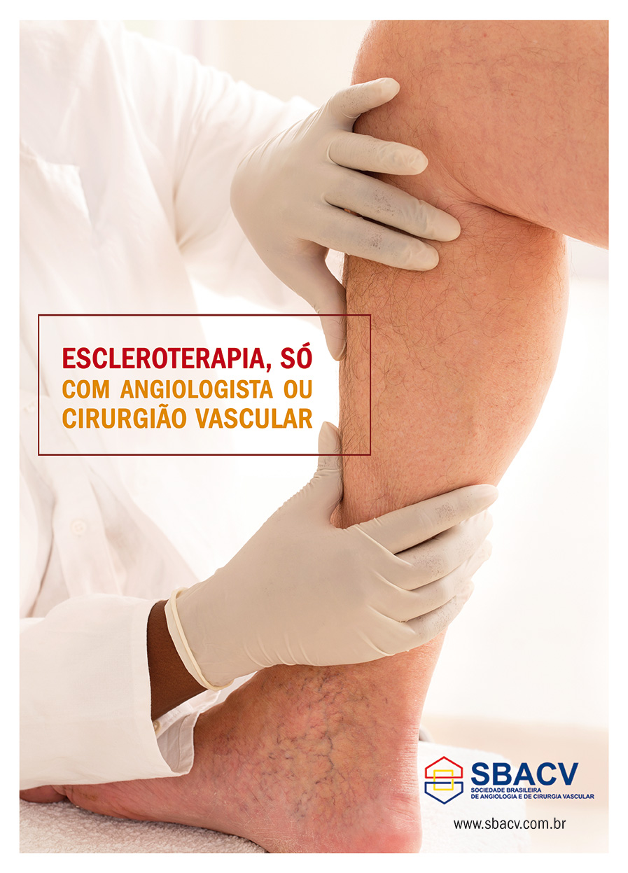 Angiologsita e Cirurgião Vascular