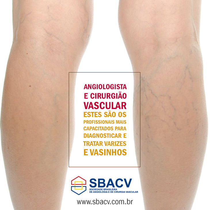 Angiologsita e Cirurgião Vascular