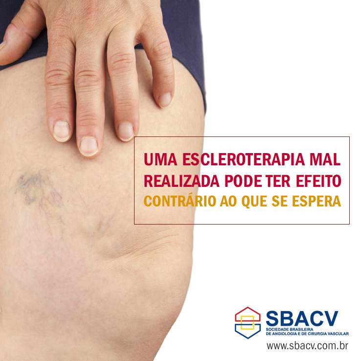 Angiologsita e Cirurgião Vascular