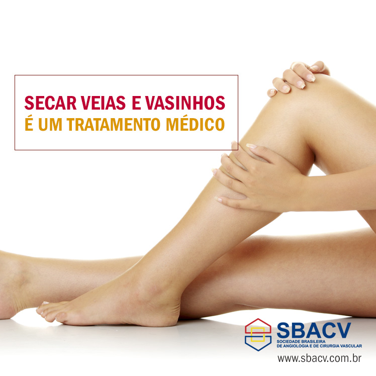 Angiologsita e Cirurgião Vascular