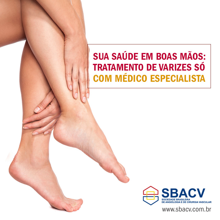Angiologsita e Cirurgião Vascular
