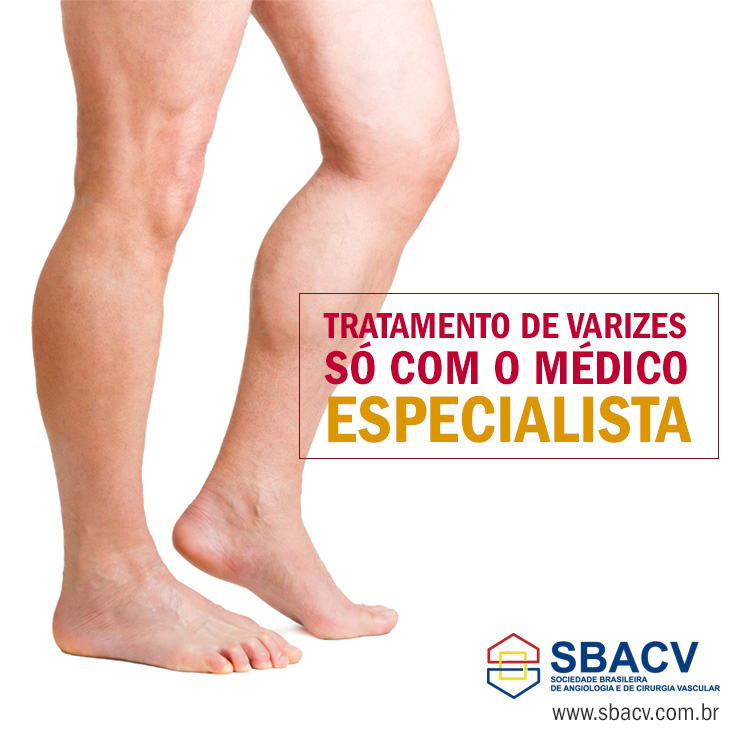 Angiologsita e Cirurgião Vascular